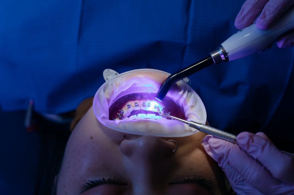 UV light curing dental procedure for teeth whitening and health care.